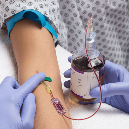 Blood culture collection from a peripheral IV catheter