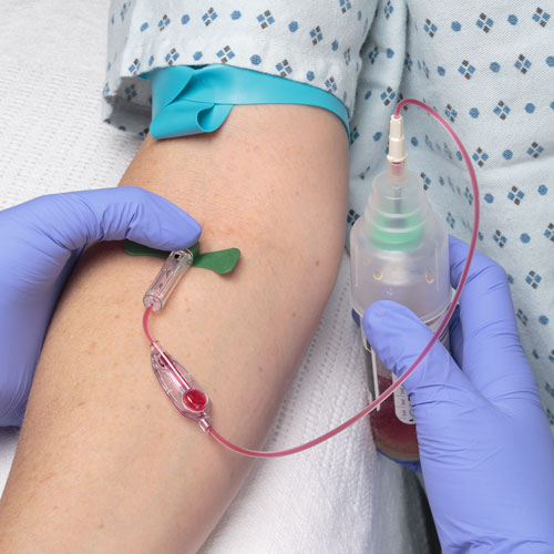 Blood draw using Kurin Jet Blood draw using Kurin Jet